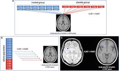 Mapping the Progressive Treatment-Related Reduction of Active MRI Lesions in Multiple Sclerosis